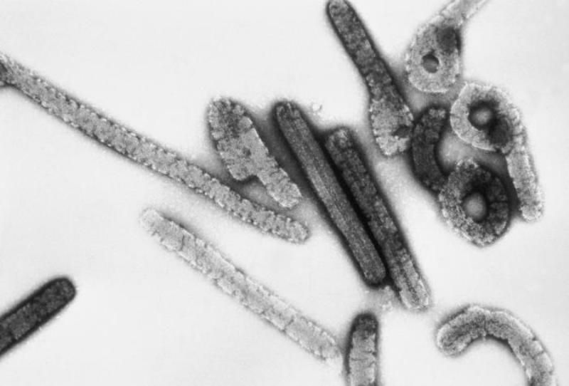 Bukan HIV Atau Ebola: Berikut Daftar Virus Paling Berbahaya Yang Mengancam Manusia 19 virus marburg