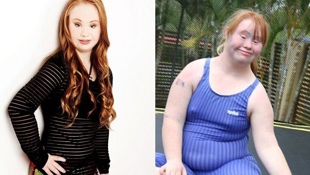Lupakan Tubuh Molek Ala Barbie, Cewek Down Syndrome Ini 