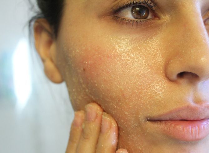 Scrub untuk menghilangkan sel kulit mati
