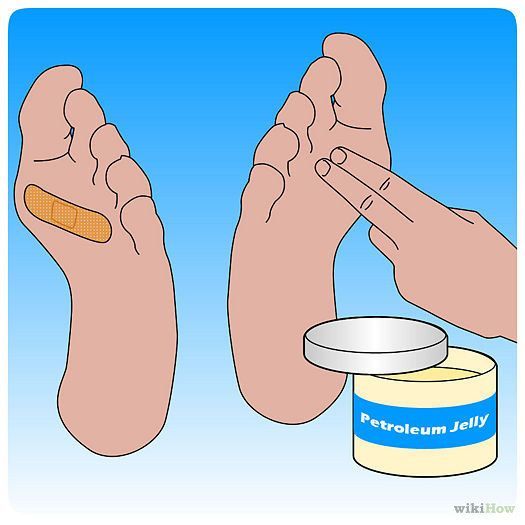 Tips dan trik mendaki gunung