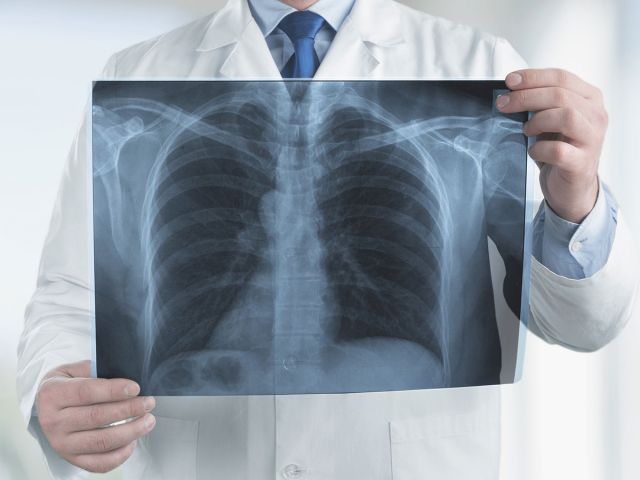 Healthy lungs