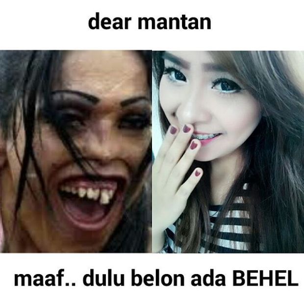 Foto ini nunjukkin kualitas behel gigi tingkat semesta. #behel besi sutet.