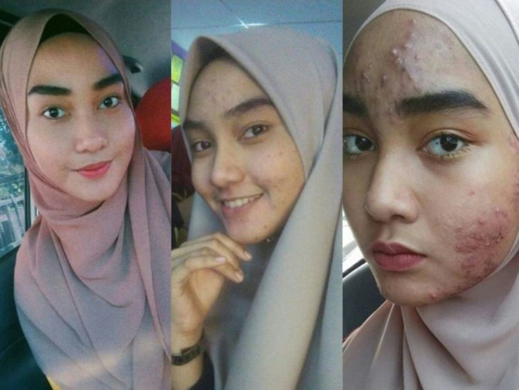 Perubahan wajah Asmida dari waktu ke waktu