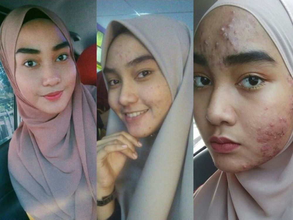 Stop Merawat Wajah dengan Produk Berbahan Kimia, Kalau Ogah Wajahmu Rusak Seperti Asmida!