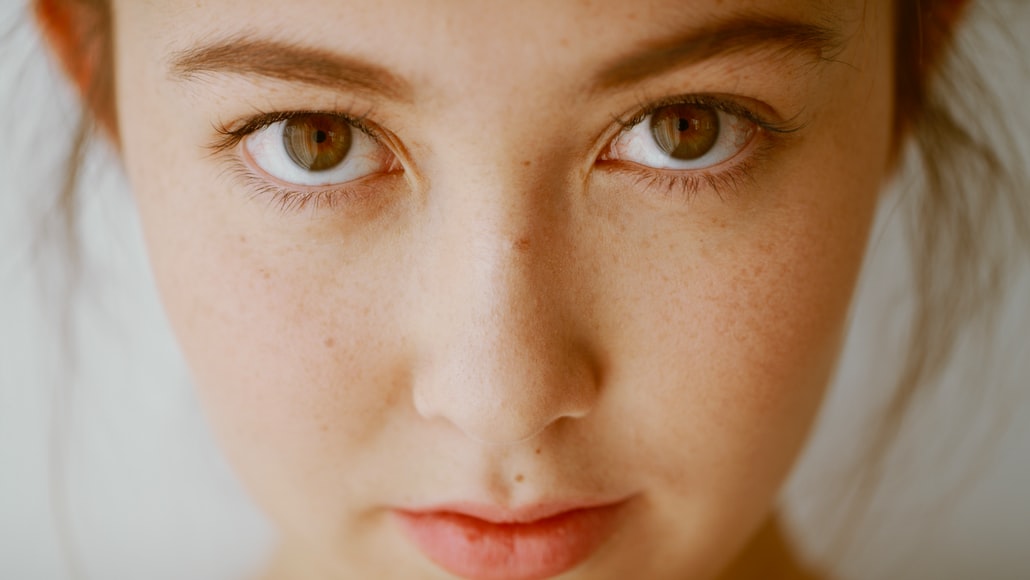 Facial Nggak Akan Menyembuhkan Wajah Berjerawat Tanpa 6 Aturan ini