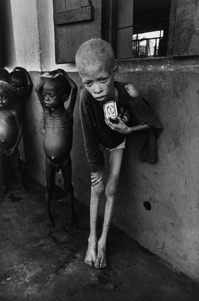 albino di biafra
