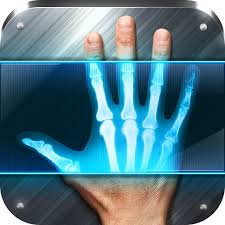 X-Ray Scanner