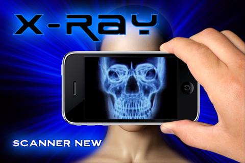 Xray Scanner Camera
