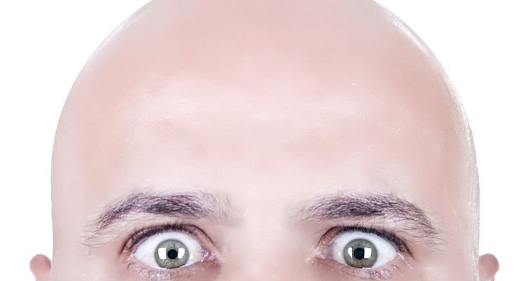 Tak Perlu Khawatir Dengan Kerontokan Rambut, Ini 7 Alasan Mengapa Pria Botak Sangat Menarik