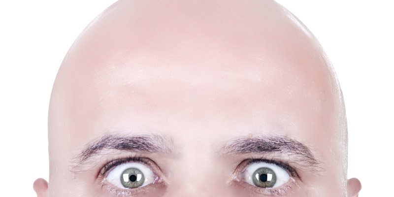 Tak Perlu Khawatir Dengan Kerontokan Rambut, Ini 7 Alasan Mengapa Pria Botak Sangat Menarik