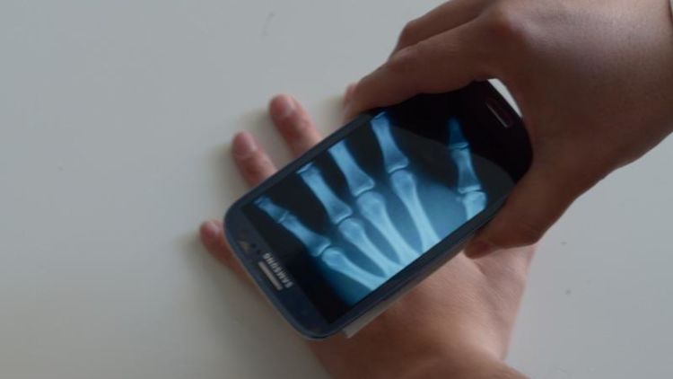 Keajaiban Teknologi! Kamera HP-mu Bisa Jadi Tembus Pandang Hanya Bermodalkan Aplikasi
