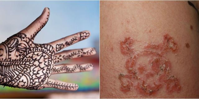 7 Cara Bedakan Henna Abal-abal dengan yang Asli Natural. Hati-hati, Kamu Bisa Aja Punya Alergi