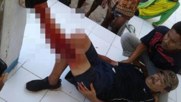 Seorang Turis Asing Digigit Komodo, Kakinya Terluka Parah Hingga Sobek. Duh, Ngeri Sekali ya!