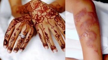 7 Cara Bedakan Henna Abal-abal dengan yang Asli Natural. Hati-hati, Kamu Bisa Aja Punya Alergi