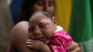 12 Foto Korban Zika Ini Sungguh Memilukan. Meski Situasi Darurat Sudah Lewat, Tetap Perlu Waspada