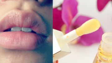 Masih Muda Kok Bibirnya Berkerut? Atasi dengan Mengoleskan 8 Bahan Alami Ini Yuk!