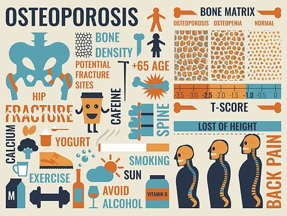 osteoporosis