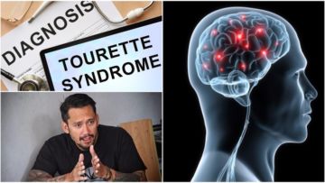 4 Fakta Tentang Tourette, Sindrom yang Sebabkan Tora Sudiro Sampai Terciduk Karena Konsumsi Dumolid