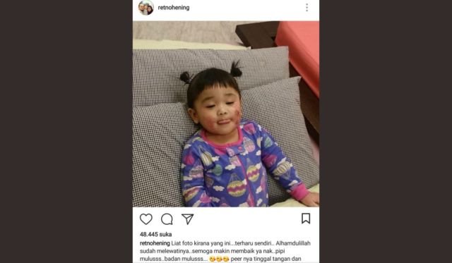 Waktu Kirana masih sakit eksim