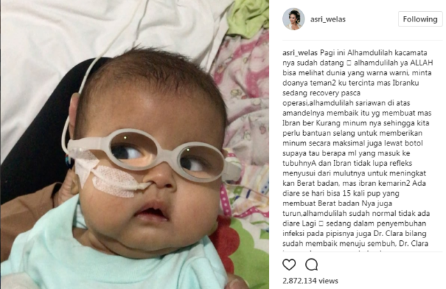 Anak Asri Welas Terkena Katarak di Usianya yang Baru 3 Bulan. Kita Doakan Agar Cepat Sembuh Yuk