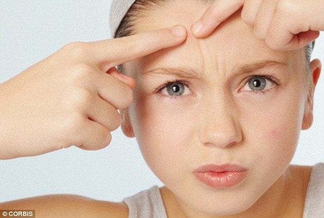 Bikin Bete! 5 Masalah Kulit Wajah yang Sering Menghampiri Wanita