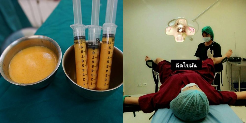 ‘3D Vag’, Tren Baru Seharga 20 Juta yang Tonjolkan Bentuk Miss V. Edan!
