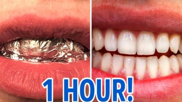 20 Fungsi Aluminium Foil dari Putihkan Gigi Hingga Perkuat Sinyal Wifi 52 20 Fungsi Aluminium Foil dari Putihkan Gigi Hingga Perkuat Sinyal Wifi