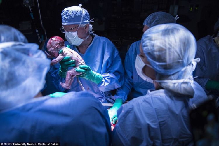 Transplantasi Rahim Janjikan Harapan Baru. Yang Divonis Tidak Akan Bisa Hamil, Kini Punya Jawaban