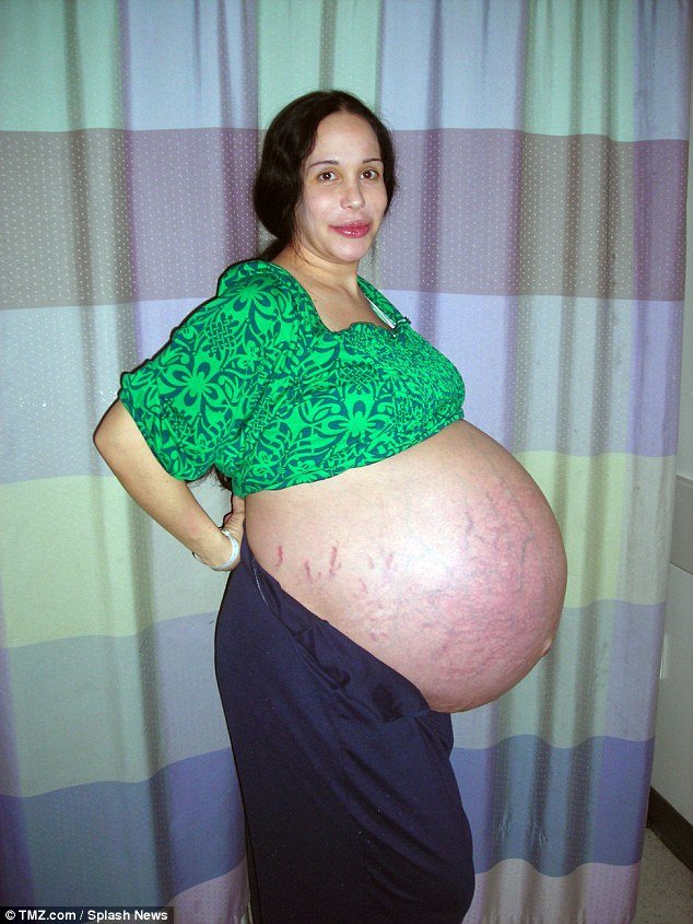Sempat Viral Sejak Hamil 8 Anak Kembar, Kini 'Octomom' Ini Telah Berdamai dengan Kehidupannya