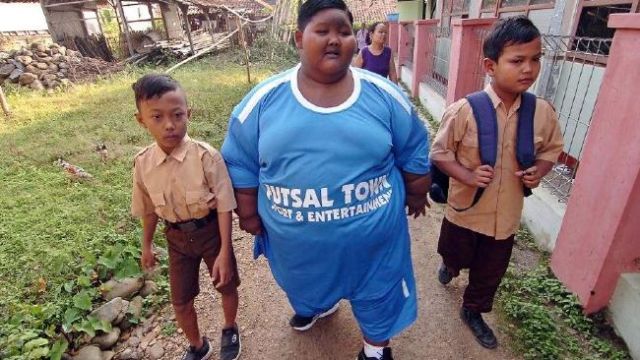 Yudi, Penderita Obesitas Meninggal Dunia. Sudah Saatnya Permasalahan Ini Jadi Perhatian Bersama