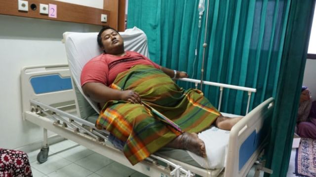 Yudi, Penderita Obesitas Meninggal Dunia. Sudah Saatnya Permasalahan Ini Jadi Perhatian Bersama
