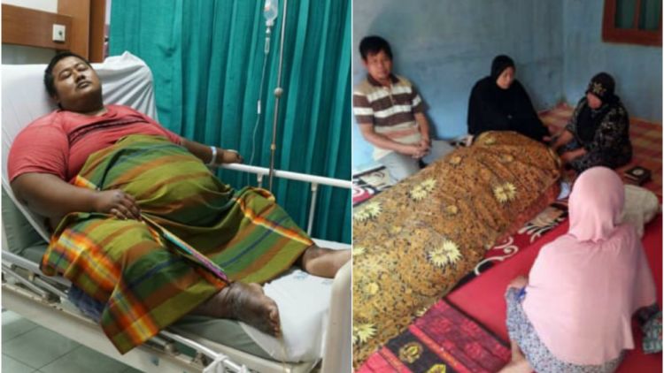 Yudi, Penderita Obesitas Meninggal Dunia. Sudah Saatnya Permasalahan Ini Jadi Perhatian Bersama