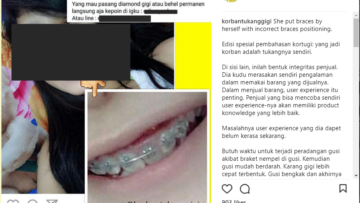 Bongkar 'Aib' Tukang Gigi, Akun IG @korbantukanggigi Tuai Pro-Kontra