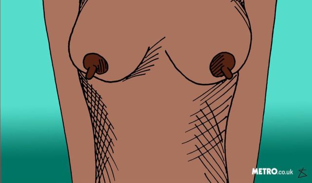 8 Macam Bentuk Puting dan Pengaruhnya dalam Menyusui. Ini Bukan Porno, Tapi Ilmu yang Perlu Kamu Ketahui 9 8 Macam Bentuk Puting dan Pengaruhnya dalam Menyusui. Ini Bukan Porno, Tapi Ilmu yang Perlu Kamu Ketahui