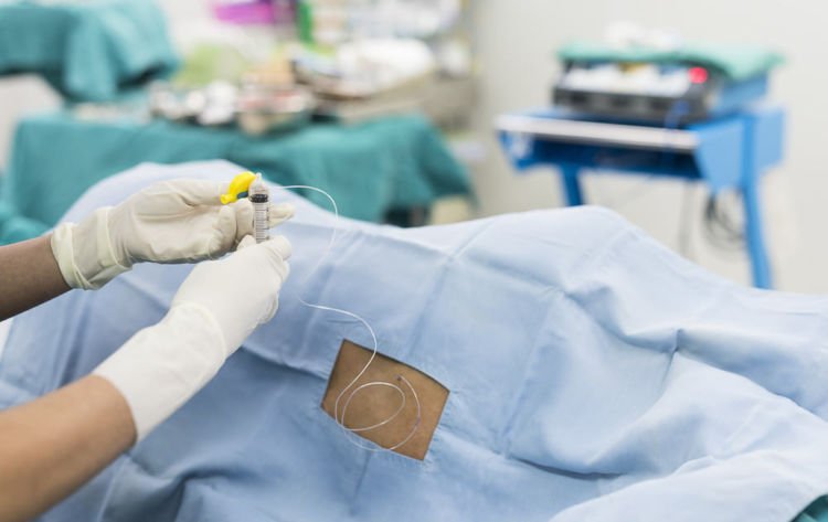 7 Fakta Penting Tentang Epidural, Bius Penahan Rasa Sakit untuk Ibu Melahirkan!