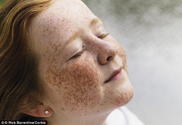 Ini Penyebab Terbentuknya Freckles di Kulit. Beda Sama Tren Make-up, Ada yang Punya Secara Alami