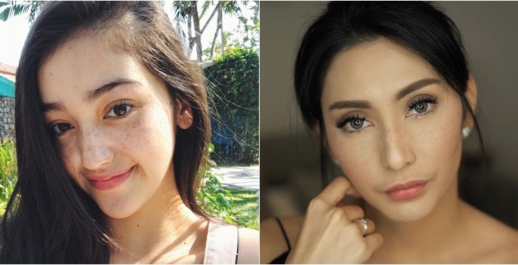 13 Artis yang Ikutan Pakai Makeup Freckles, Bahkan Ada yang Aslinya Gitu. Seger Banget Nggak Sih?