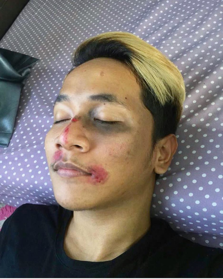 Setelah Young Lex Mengaku Dipukuli K-Popers, Kini Warganet Juga Ikutan 'Dipukuli'. Ngejek nih?
