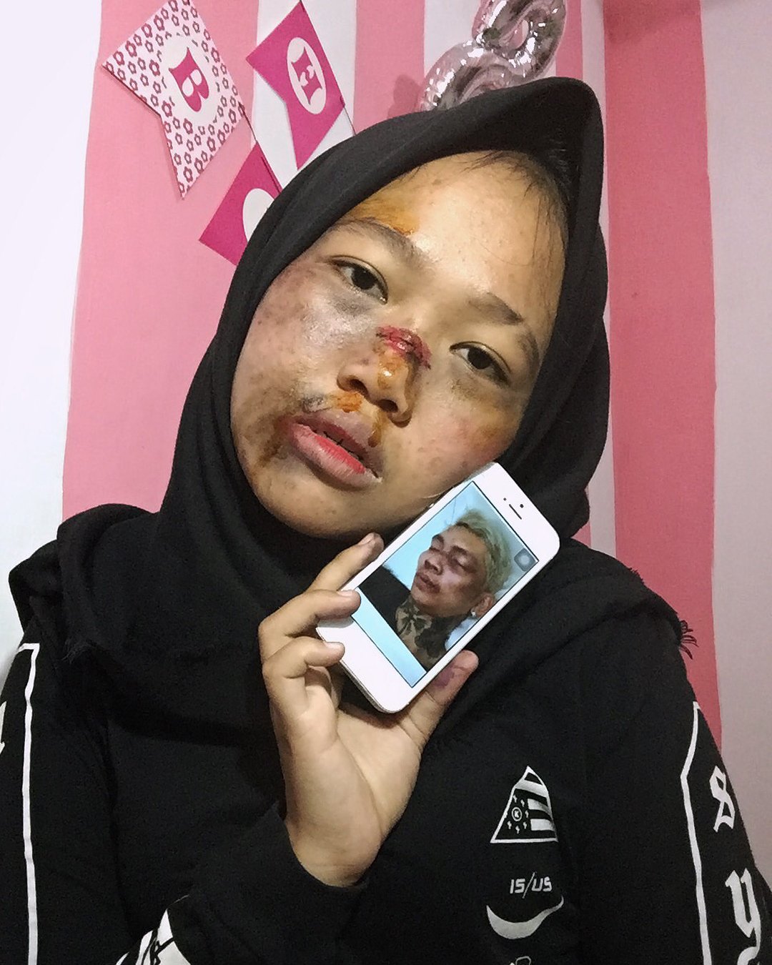 Setelah Young Lex Mengaku Dipukuli K-Popers, Kini Warganet Juga Ikutan 'Dipukuli'. Ngejek nih?