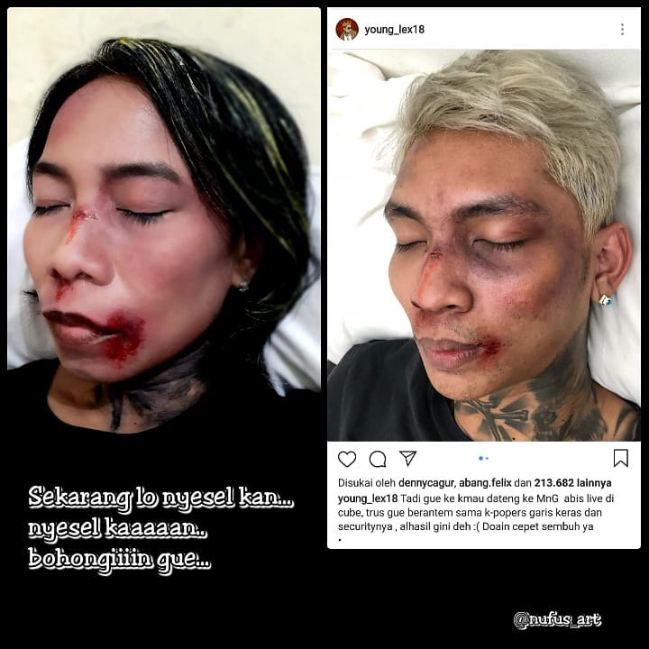 Setelah Young Lex Mengaku Dipukuli K-Popers, Kini Warganet Juga Ikutan 'Dipukuli'. Ngejek nih?