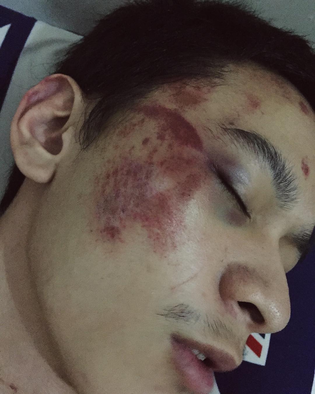 Setelah Young Lex Mengaku Dipukuli K-Popers, Kini Warganet Juga Ikutan 'Dipukuli'. Ngejek nih?