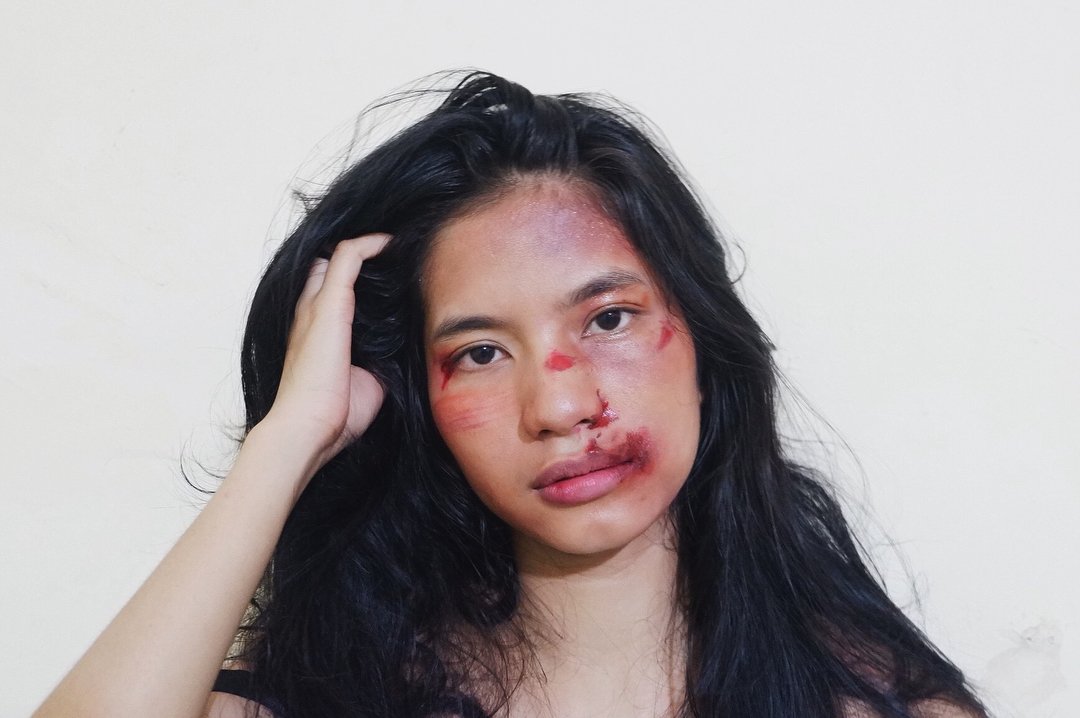 Setelah Young Lex Mengaku Dipukuli K-Popers, Kini Warganet Juga Ikutan 'Dipukuli'. Ngejek nih?