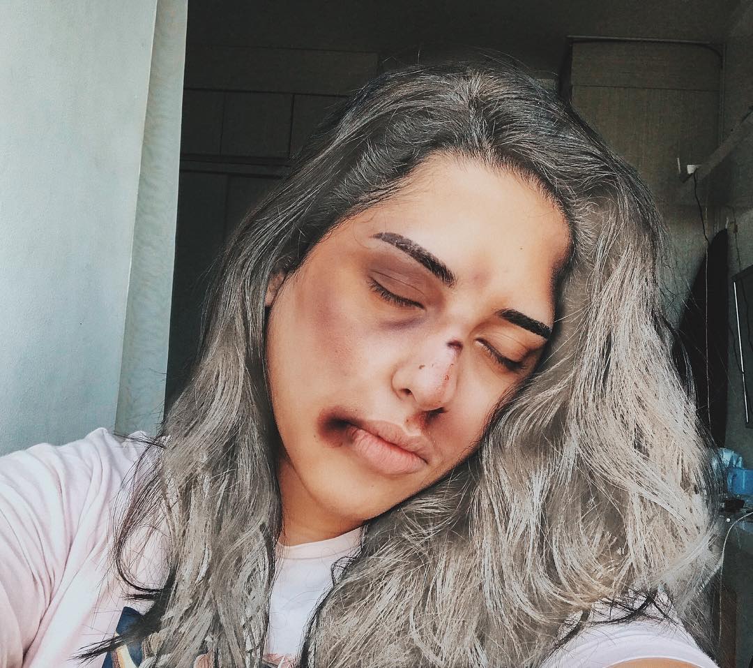 Setelah Young Lex Mengaku Dipukuli K-Popers, Kini Warganet Juga Ikutan 'Dipukuli'. Ngejek nih?