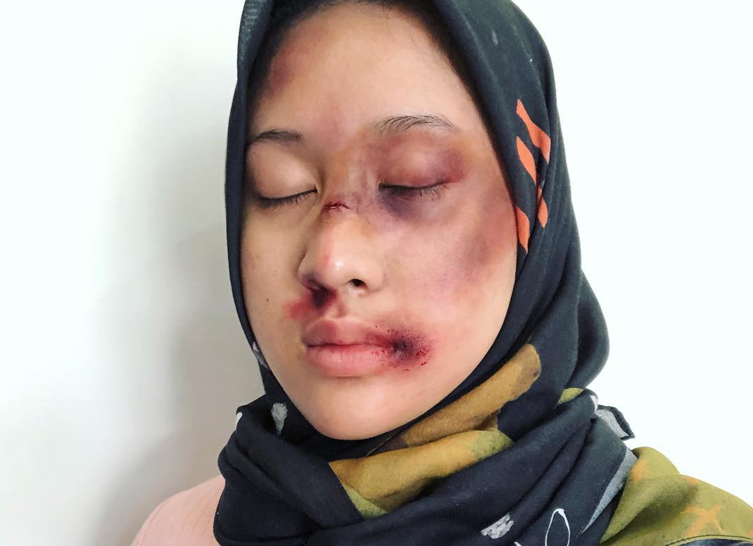 Setelah Young Lex Mengaku Dipukuli K-Popers, Kini Warganet Juga Ikutan 'Dipukuli'. Ngejek nih?