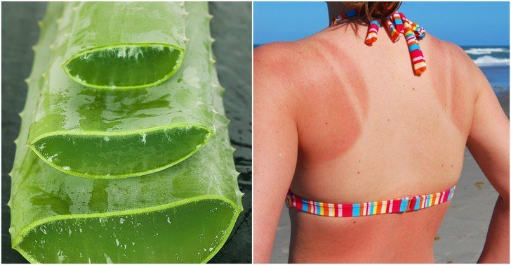 Aloe Vera Disebut-sebut Ampuh Atasi Sunburn. Fakta atau Hanya Sebatas Sugesti Saja?