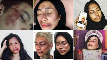 Setelah Young Lex Mengaku Dipukuli K-Popers, Kini Warganet Juga Ikutan ‘Dipukuli’. Ngejek nih?