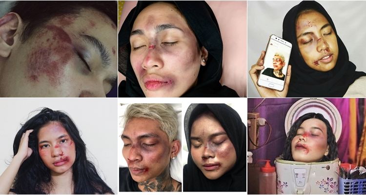Setelah Young Lex Mengaku Dipukuli K-Popers, Kini Warganet Juga Ikutan ‘Dipukuli’. Ngejek nih?