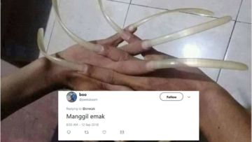 Lihat Kuku Begini, Warganet Jadi Penasaran sama Satu Hal. Tapi Jawabannya Lebih Nggak Masuk Akal sih