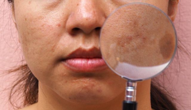 12 Gambaran Unik Semi Bikin Geli yang Terjadi Selama Kehamilan. Jangan Panik, Ini Normal! 25 12 Gambaran Unik Semi Bikin Geli yang Terjadi Selama Kehamilan. Jangan Panik, Ini Normal!