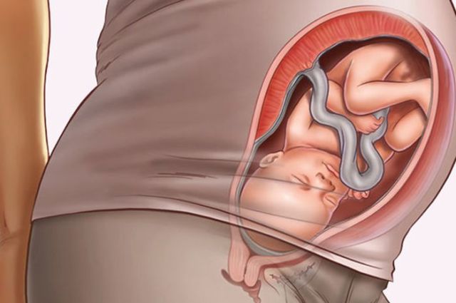 4 Manfaat Birthing Ball untuk Kehamilan & Persiapan Melahirkan. Jelas Bukan Gaya-gayaan Doang!